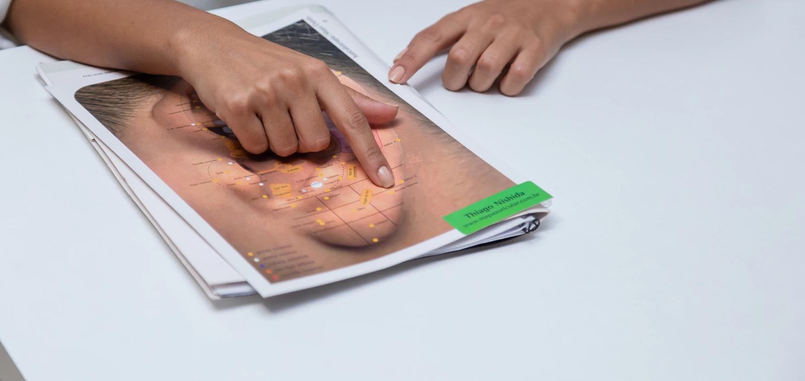 Use of Botulinum Toxin on Hunger Points - APPETITE REGULATION