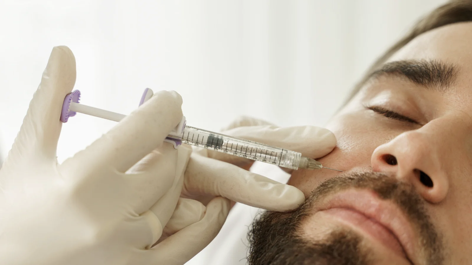 Fillers – Hyaluronic Acid – Basic