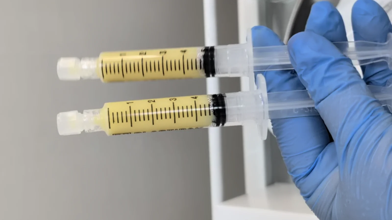 Biofiller + Stem Cells – Combined Treatments